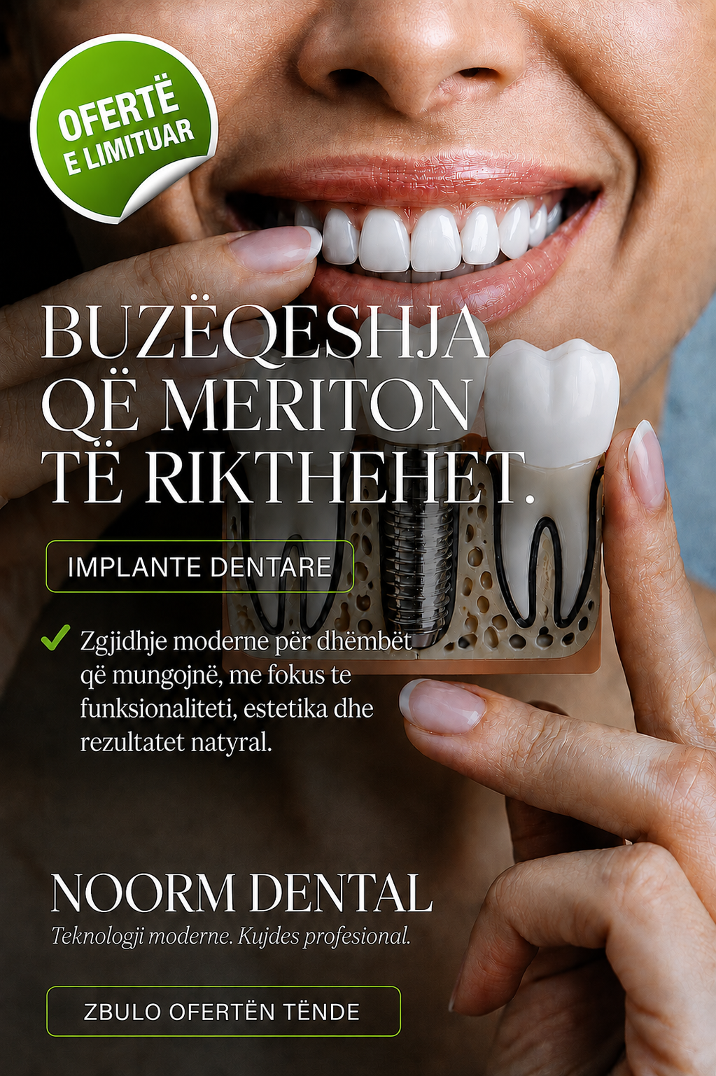 Dental Implants